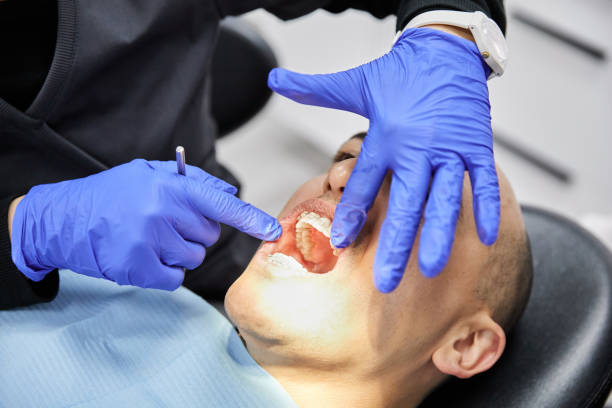 Best Pediatric Emergency Dentist in Cavalero, WA